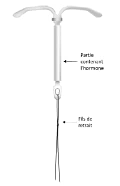 Stérilet hormonal KYLEENA