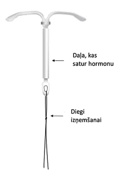 Kyleena hormonālā spirāle