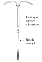Dispositivo intrauterino hormonal Kyleena
