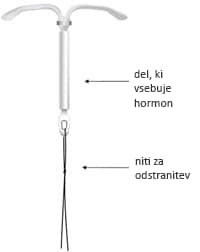 Maternični vložek s hormonom (zdravilo Kyleena)