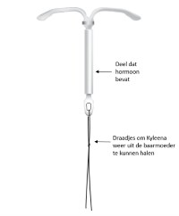De Kyleena hormoonspiraal