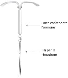 La spirale ormonale Kyleena