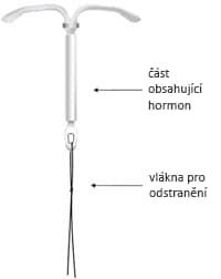 Obrázek 1: Kyleena